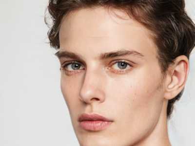 激光除痣：安全有效，不留疤痕的祛痣新选择